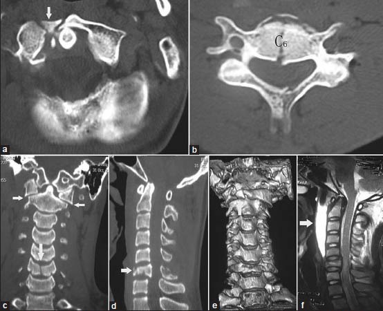 Figure 3A