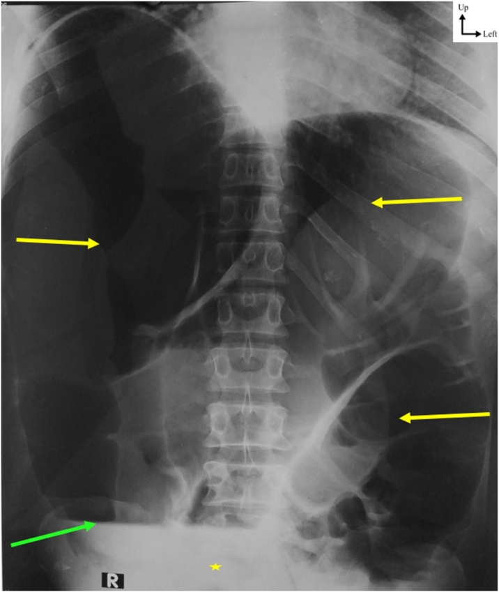 Fig. 1