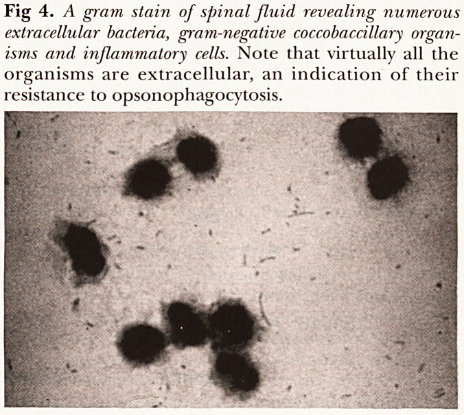 Fig 4.