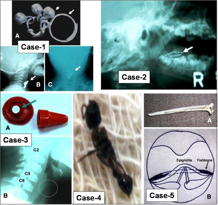 Fig. 1