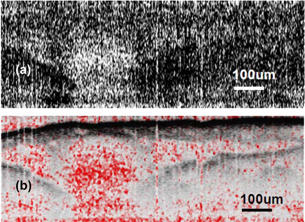 Fig. 13