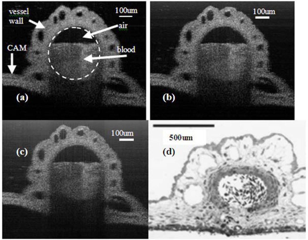 Fig. 11