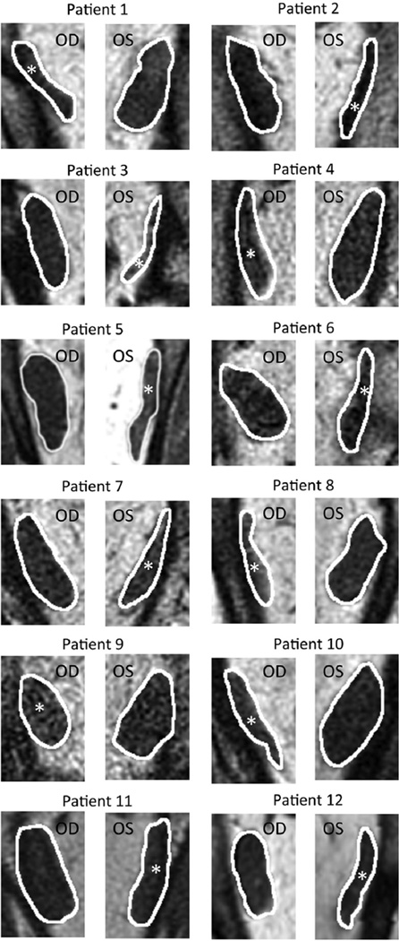 FIGURE 3