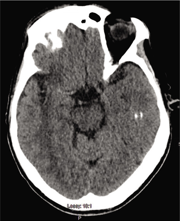 Figure 1: