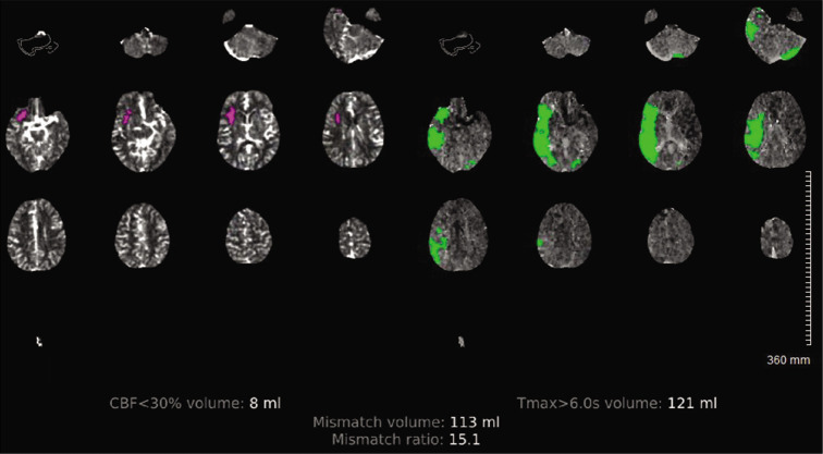 Figure 3: