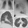Fig. 9