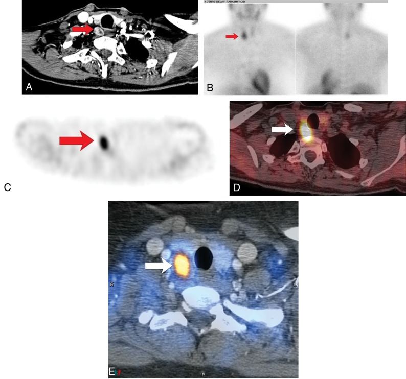 Fig 3.