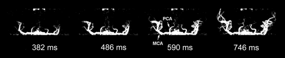 Figure 4b: