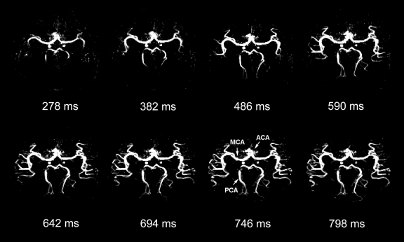 Figure 4a: