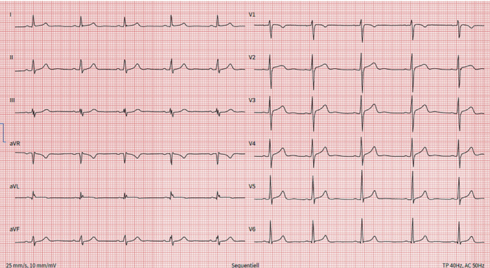 EJHF-2669-FIG-0002-c