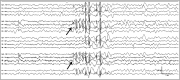 Figure 1-1.
