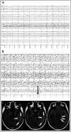 Figure 1-6.