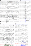 Figure 1-3.