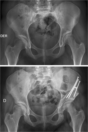 Fig. 1–2