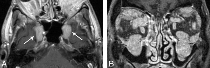 Fig 5.