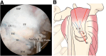 Fig 14