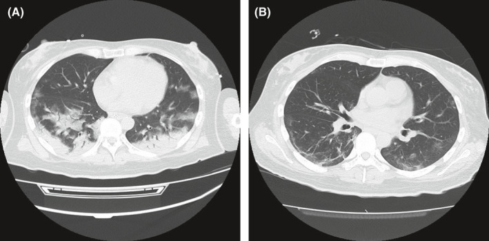 FIGURE 1