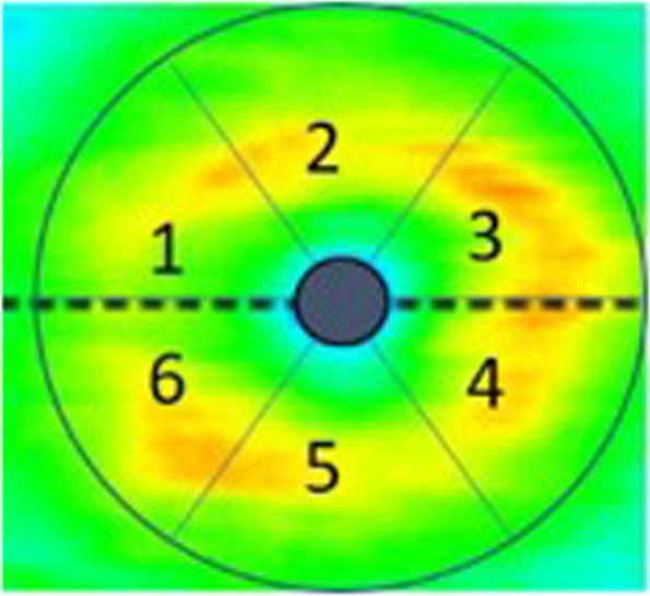 Fig. 2