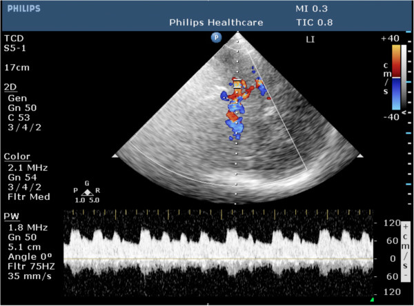 Figure 7