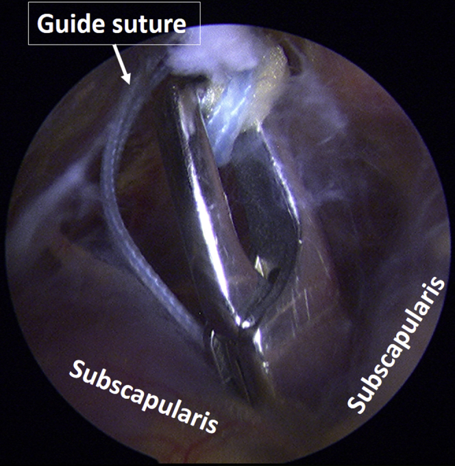 Fig 4