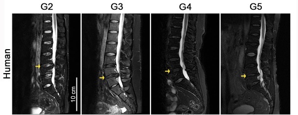 Figure 1—figure supplement 1.