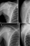 Fig. 1A–D