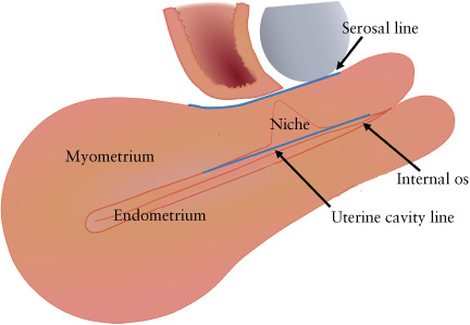 UOG-24815-FIG-0004-c