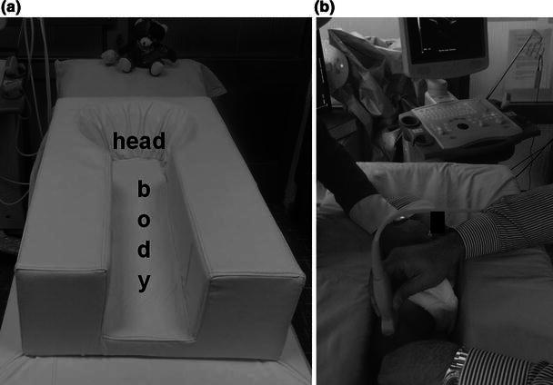 Fig. 1