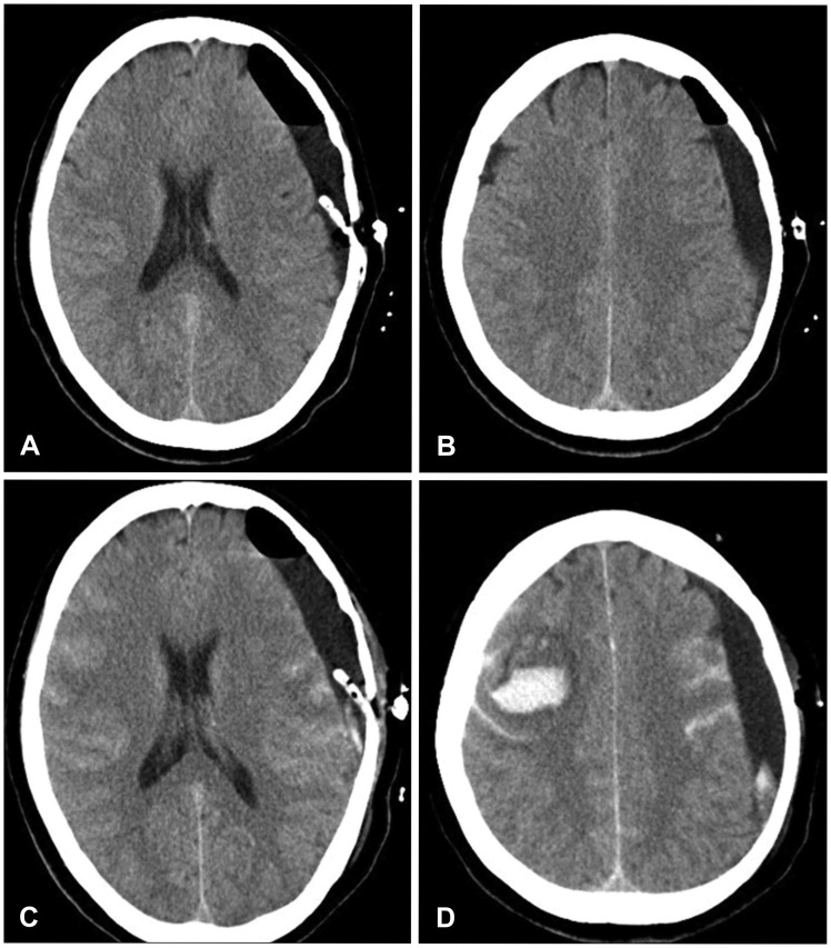 FIGURE 2