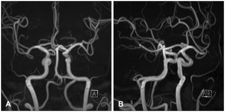 FIGURE 3