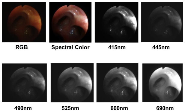 Fig. 4