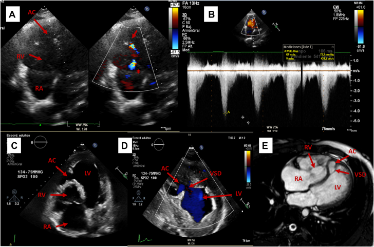 Figure 1