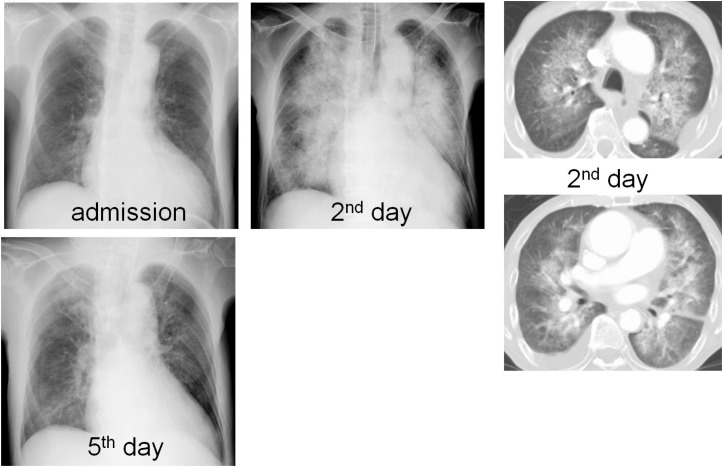 Fig. 2