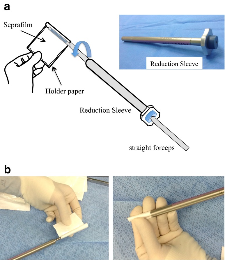 Fig. 2