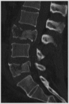 Fig.1