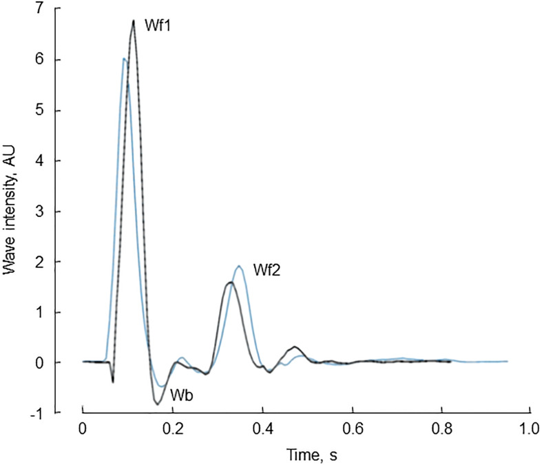 FIGURE 4