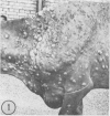 180