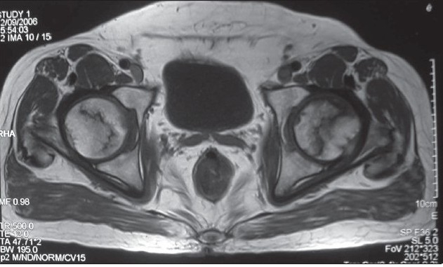 Figure 1C