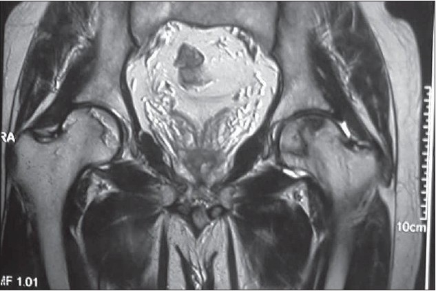 Figure 1B