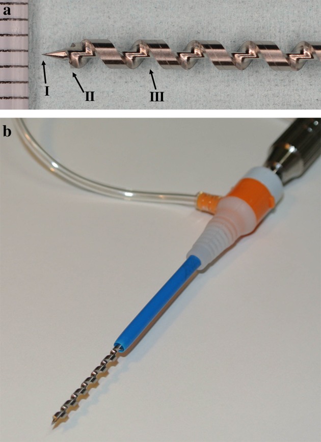 Fig. 1