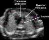 Figure 7: