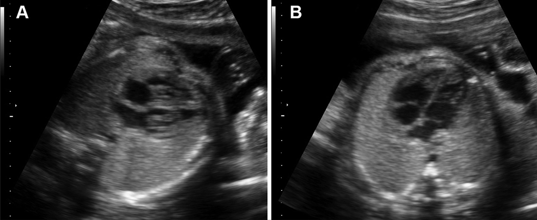 Figure 4: