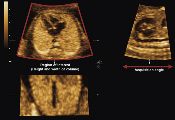 Figure 1: