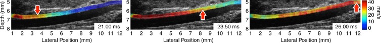 Figure 1a: