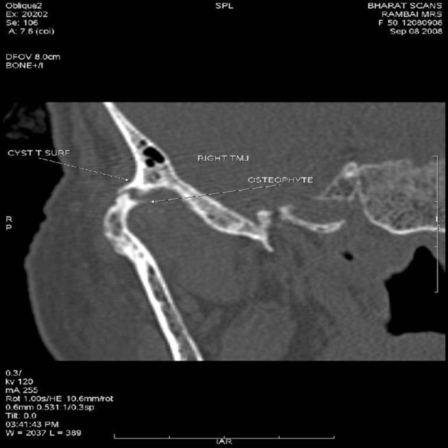 Fig. 3