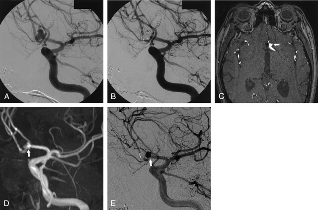 Fig 4.