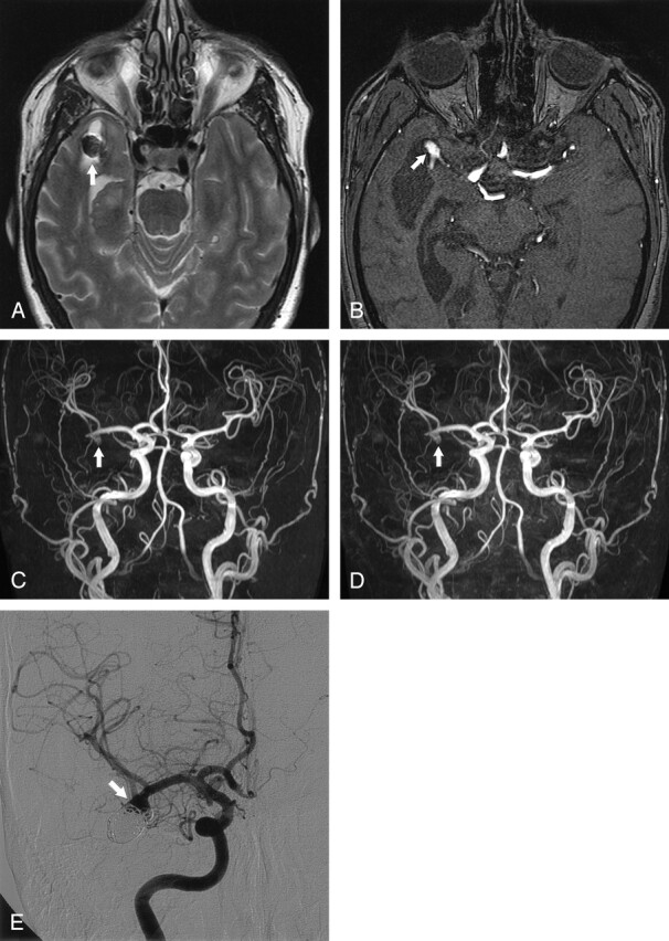 Fig 3.