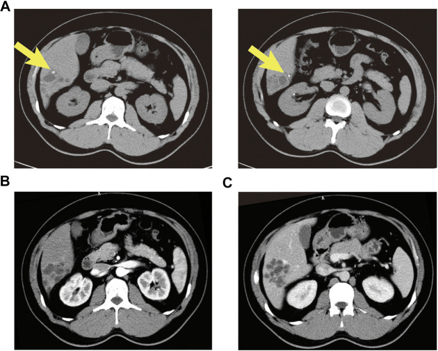 FIGURE 1