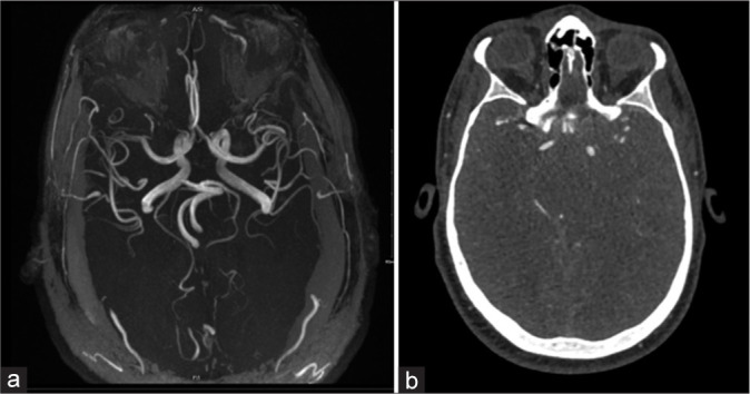 Figure 3: