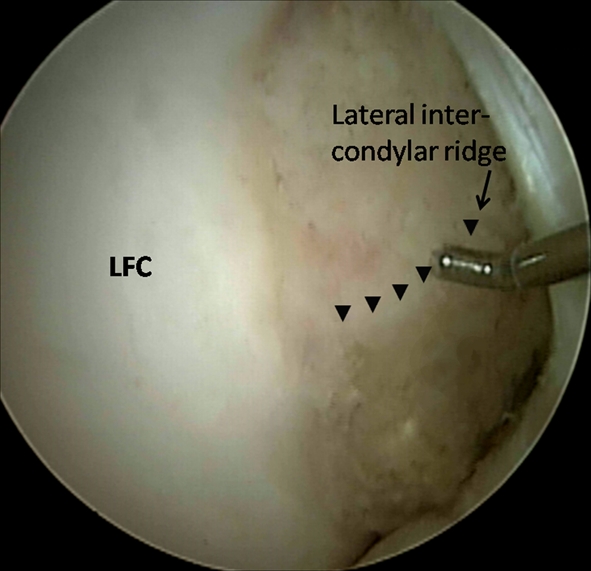 Fig. 2